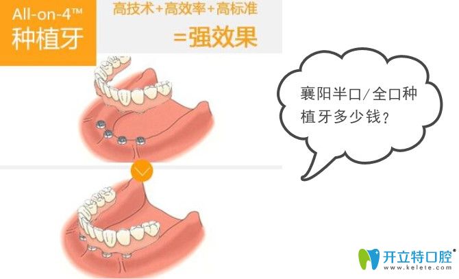 矫正牙齿价格走势揭秘，2017年市场趋势聚焦
